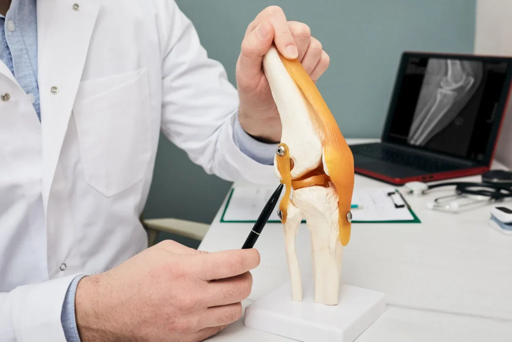 Ligamento cruzado posterior cuándo intervenir