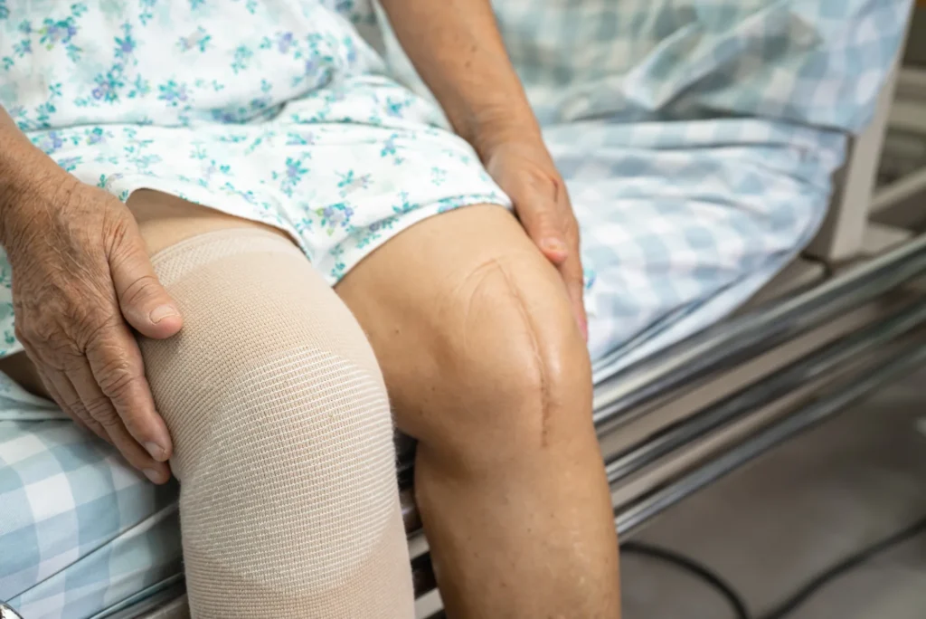 Reemplazo parcial de rodilla (pkr) ventajas