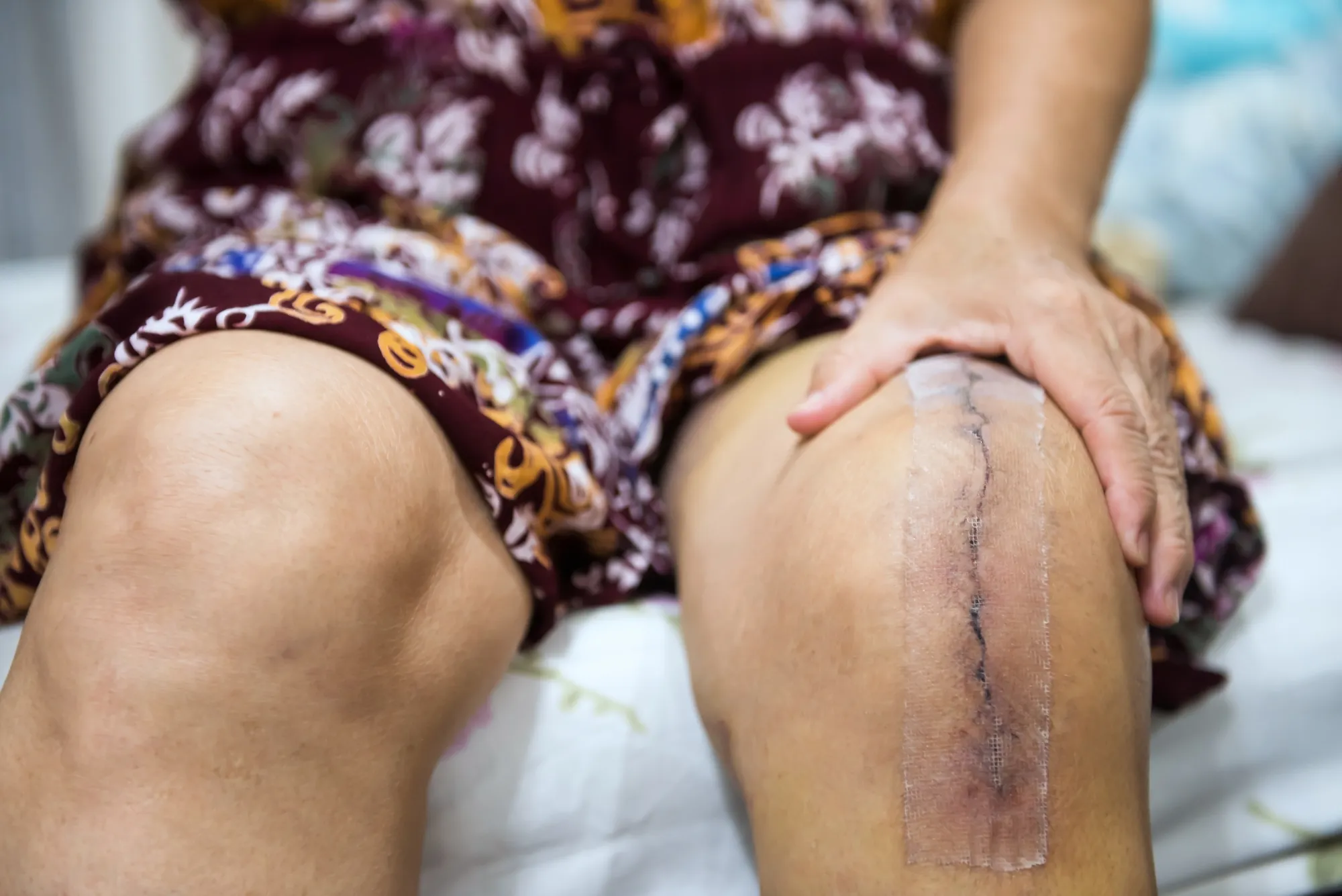 Cirugía de reemplazo articular de rodilla cómo recuperar movilidad y eliminar el dolor con la técnica más avanzada