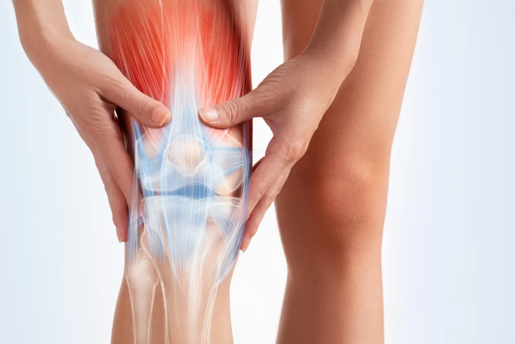 Corrección de eje de rodilla osteotomía