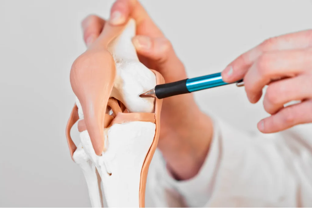 Reparación artroscópica de cartílago articular técnica innovadora para frenar el desgaste y mejorar la calidad de vida