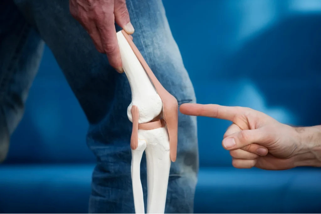 Desgaste de cartílago en la rodilla cómo frenar el avance y recuperar tu calidad de vida con técnicas modernas