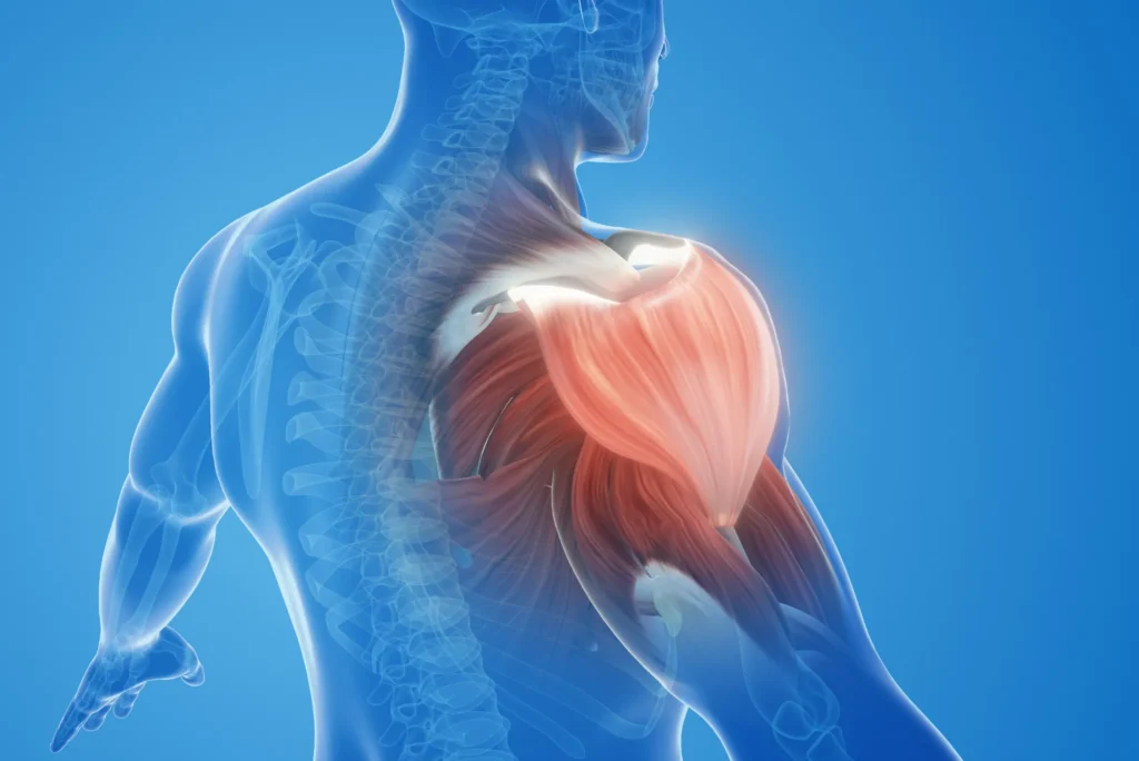 Lesiones del labrum glenoideo cuándo operar
